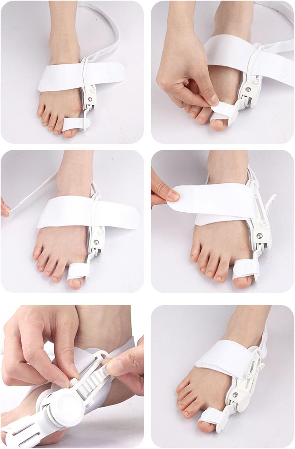 AlignRelief Premier Verstelbare Hallux Valgus Correctie Oplossing