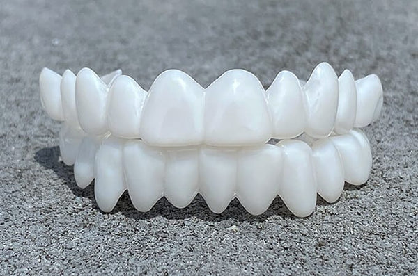 Simulatie Tandheelkundige Beugel – Realistisch Tandmodel voor Comfort en Gemak