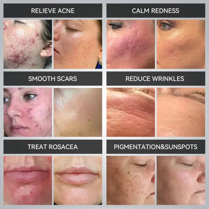 Revitaliseer je huid met onze 7 kleurige LED lichttherapie masker Ervaar spa kwaliteit huidverzorging in het comfort van je eigen huis!